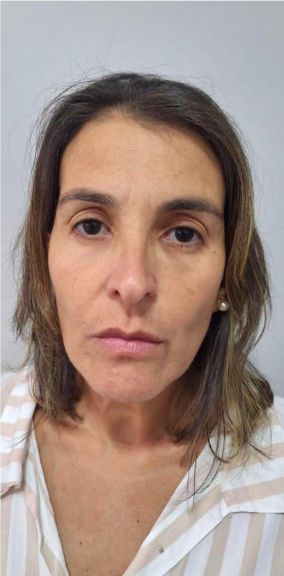 Depois